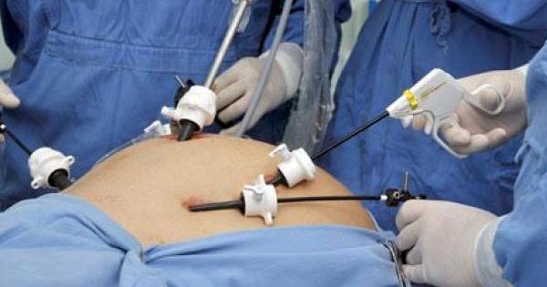 Este ano, só a prefeitura de Goiânia realizou 53 procedimentos | Foto: Reprodução