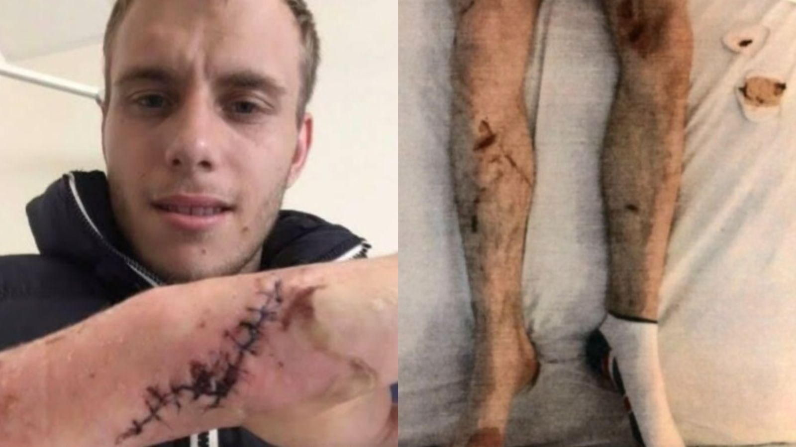 Rapaz era espancado, sofreu queimaduras por ter água quente jogada no corpo, estrangulado e proibido de se alimentar corretamente | Foto: reprodução