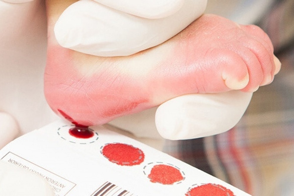 Governo do Estado busca ampliar os Serviços de Referências em Doenças Raras pelo Ministério da Saúde