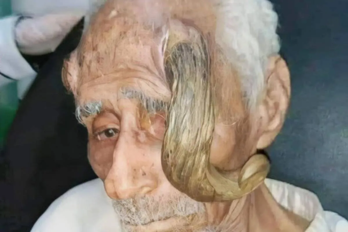 Homem que dizia ter 140 anos morre após tentar remover ‘chifres’, na Arábia | Foto: Reprodução