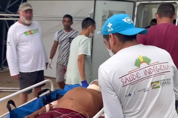 Liderança Yanomami denunciou que a comunidade Uxiú foi atacada por garimpeiros armados que “alvejaram” os três indígenas | Foto: Júnior Hekurari/Redes sociais