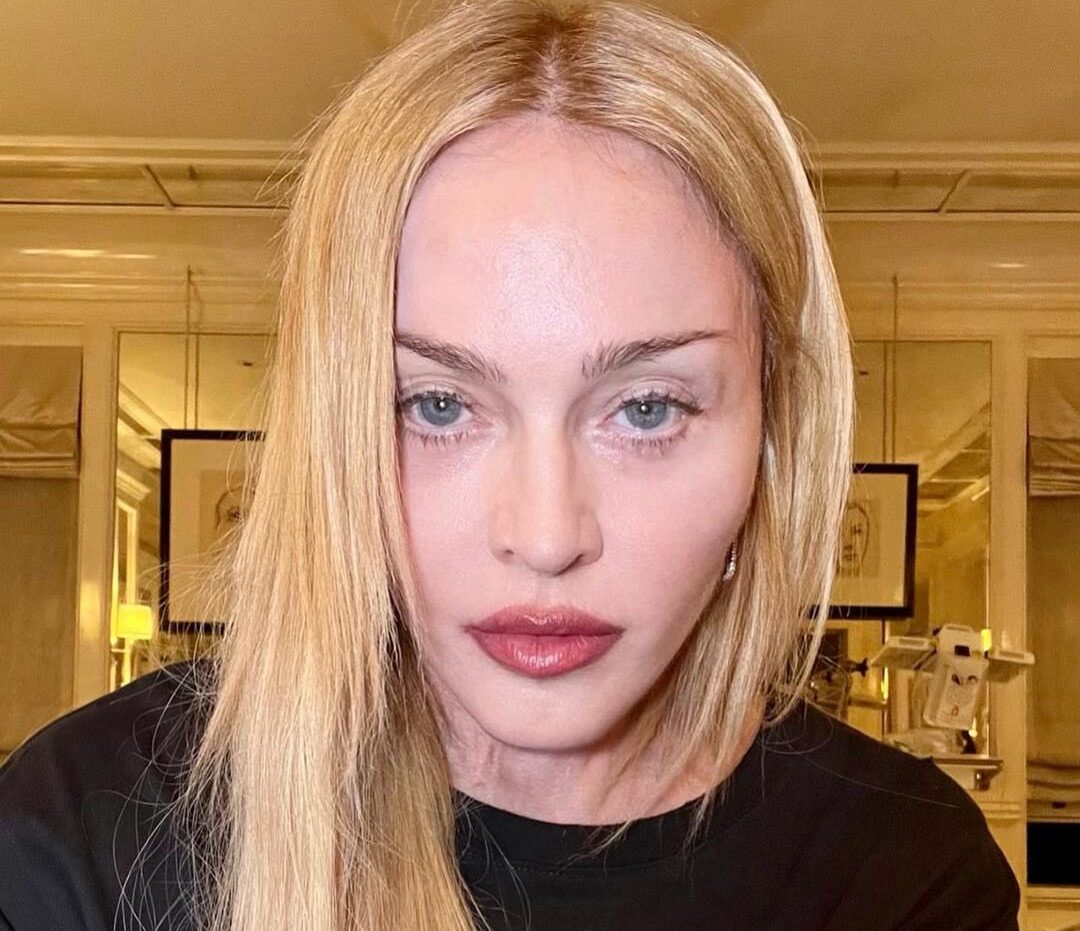 Madonna deu entrada na UTI no dia 24 de junho devido a uma infecção bacteriana | Foto: Reprodução/Twitter
