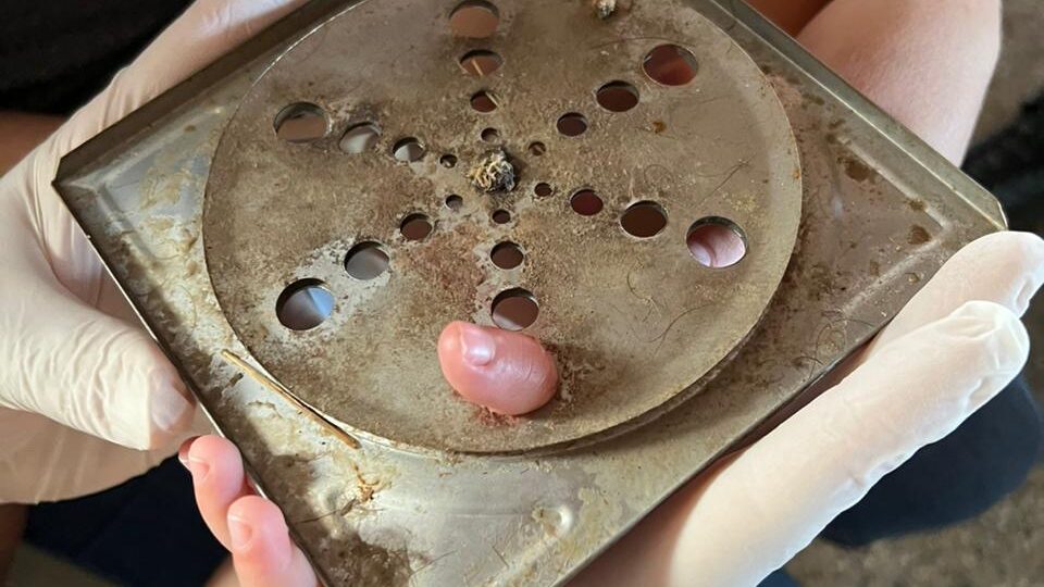 criança-dedo-ralo-bombeiros