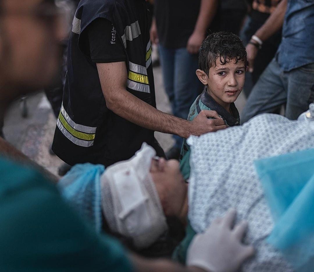 Criança assustada vendo a mãe entrar no hospital depois de ter sido ferida por um ataque aéreo israelense | Foto: Motaz Azaiza