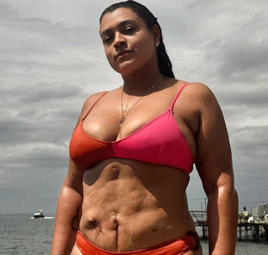 Preta Gil responde criticas ao mostrar cicatrizes na barriga