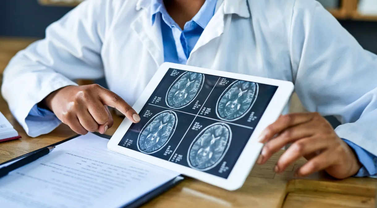 De acordo com o Instituto Nacional de Câncer (INCA), atualmente, o Brasil registra cerca de 11 mil novos casos de tumor cerebral todos os anos. | Foto: Reprodução