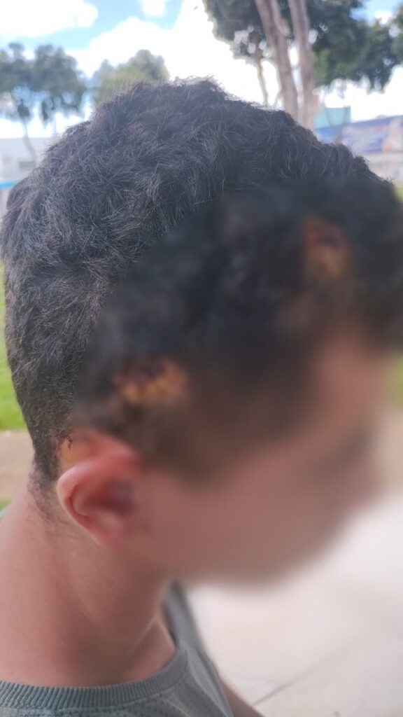 Membro de torcida organizada é preso por agressão a torcedor rival; veja vídeo