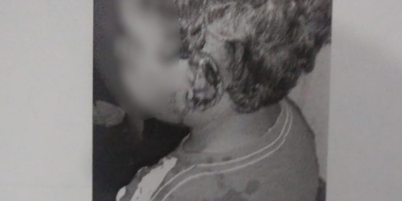Foto: Reprodução/Polícia Civil Padrasto é preso por agredir e cortar orelha de enteado de 4 anos