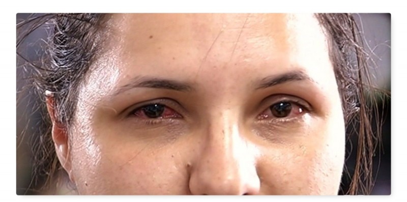 b3bc6c5ed7620a8d1acefa9aacd5f6ba