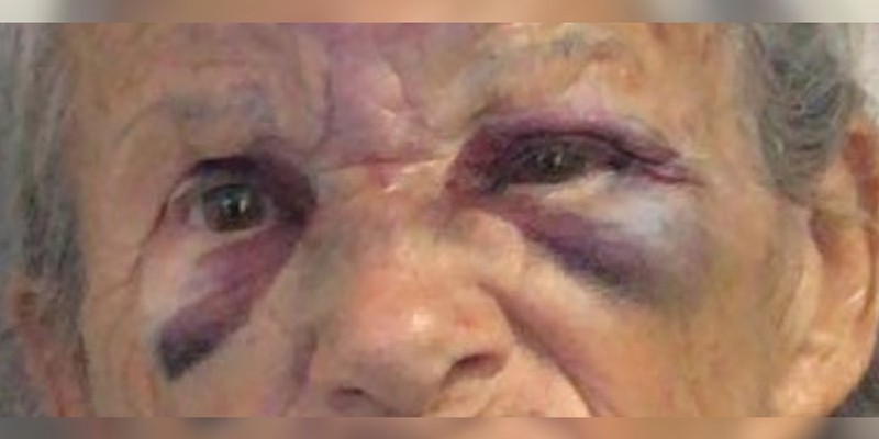 Idosa de 83 é agredida durante tentativa de assalto (Foto: Reprodução) Jovem suspeito de agredir vizinha idosa é preso em Morrinhos