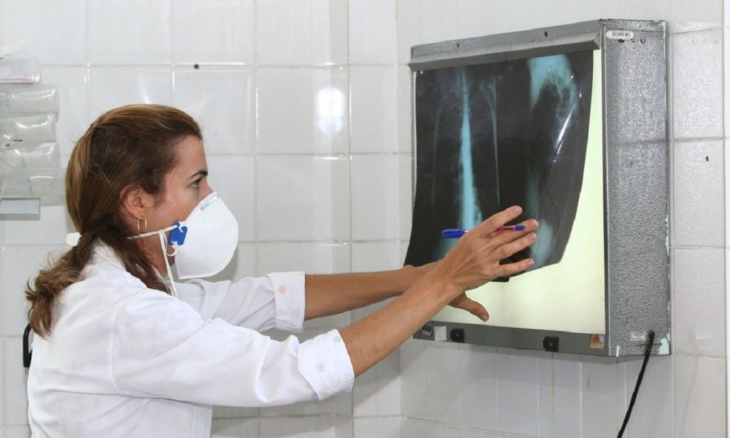 Imagem Ilustrando a Notícia: Fiocruz vai testar eficácia da vacina contra tuberculose para Covid-19