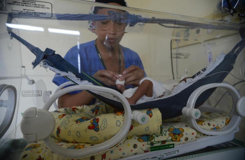Imagem Ilustrando a Notícia: Continua grave o estado de saúde da gêmea siamesa