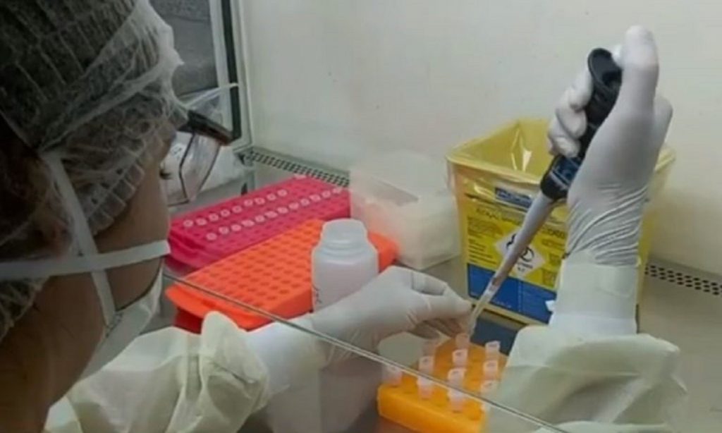 Imagem Ilustrando a Notícia: Goiânia já soma quase três mil testes com diagnóstico positivo para coronavírus