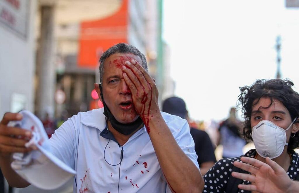 Imagem Ilustrando a Notícia: Protestos contra Bolsonaro são marcados por violência contra manifestantes em Recife-PE