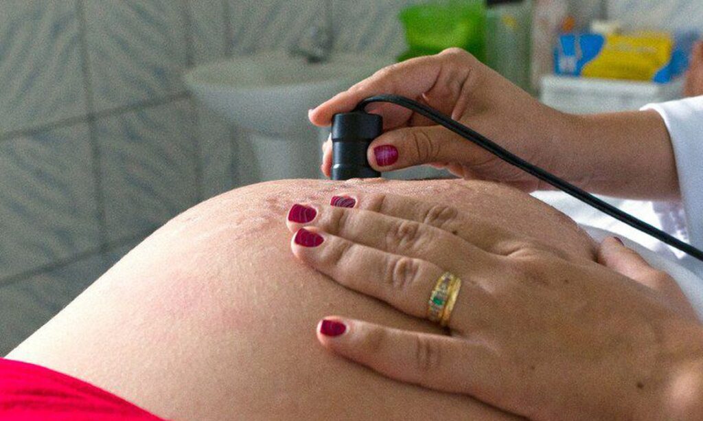 Imagem Ilustrando a Notícia: Número de óbitos de grávidas em 2021 já ultrapassa todo ano de 2020