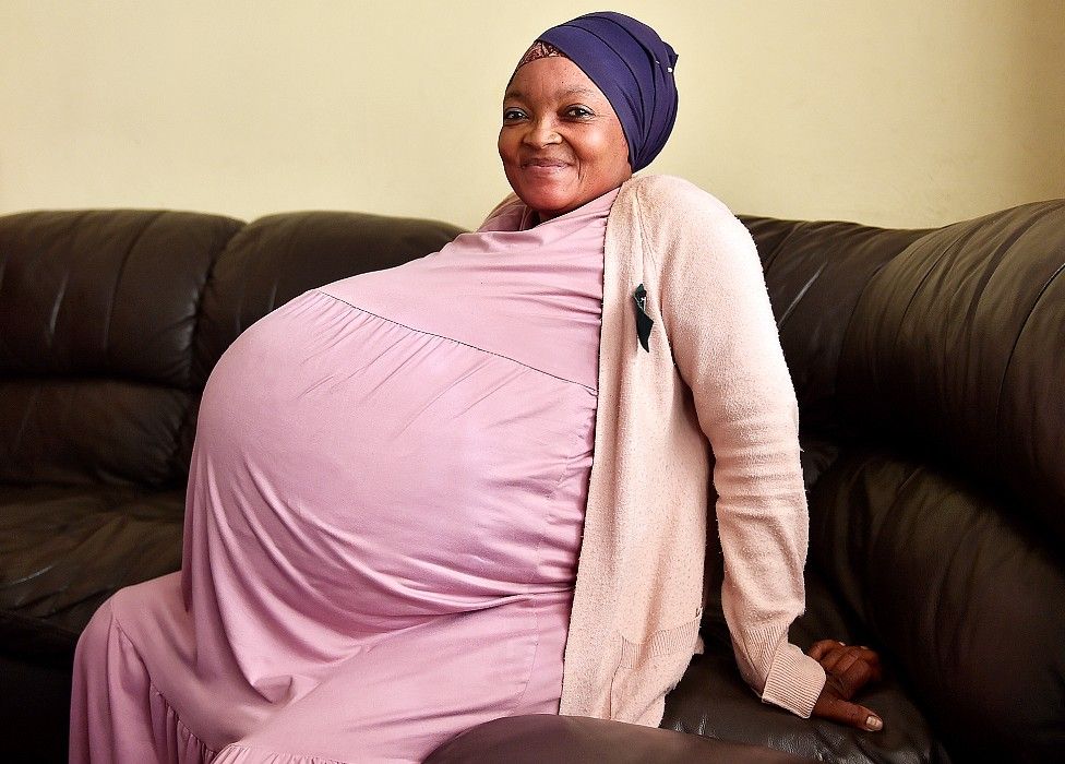 Imagem Ilustrando a Notícia: Mulher dá à luz a dez bebês em uma única gestação na África do Sul