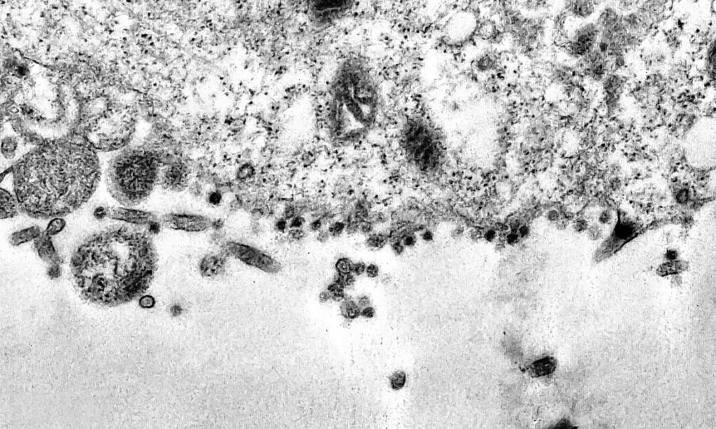 Imagem Ilustrando a Notícia: África do Sul detecta nova variante do coronavírus e estuda mutações