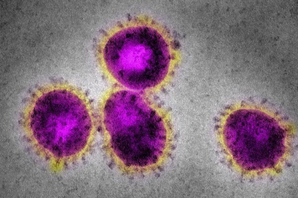 Imagem Ilustrando a Notícia: OMS passa a monitorar nova cepa do coronavírus nomeada como Variante Mu