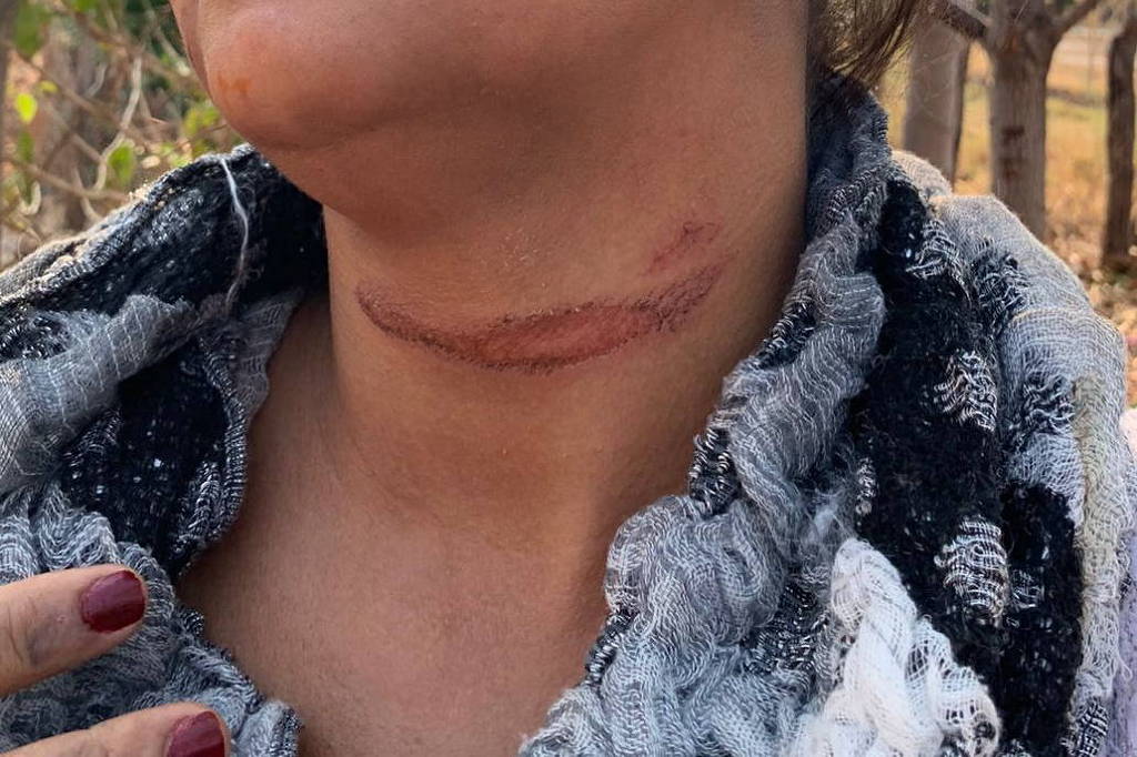 Imagem Ilustrando a Notícia: Vereador de Minas Gerais é suspeito de amarrar mulher em árvore pelo pescoço, entenda o caso