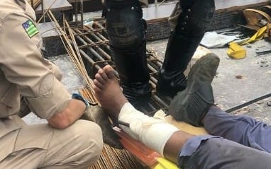 Imagem Ilustrando a Notícia: Homem tem perna atravessada por objeto de aço em construção civil na Capital