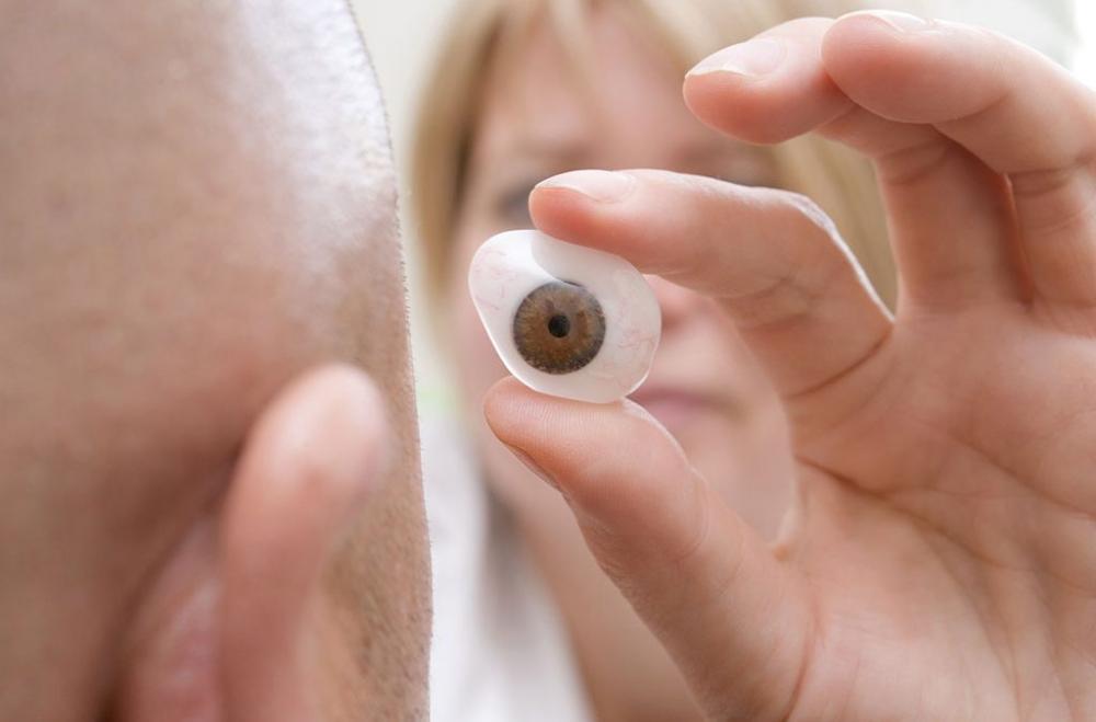 Imagem Ilustrando a Notícia: Paciente irá receber uma prótese de ocular impressa em 3D  pela primeira vez na história