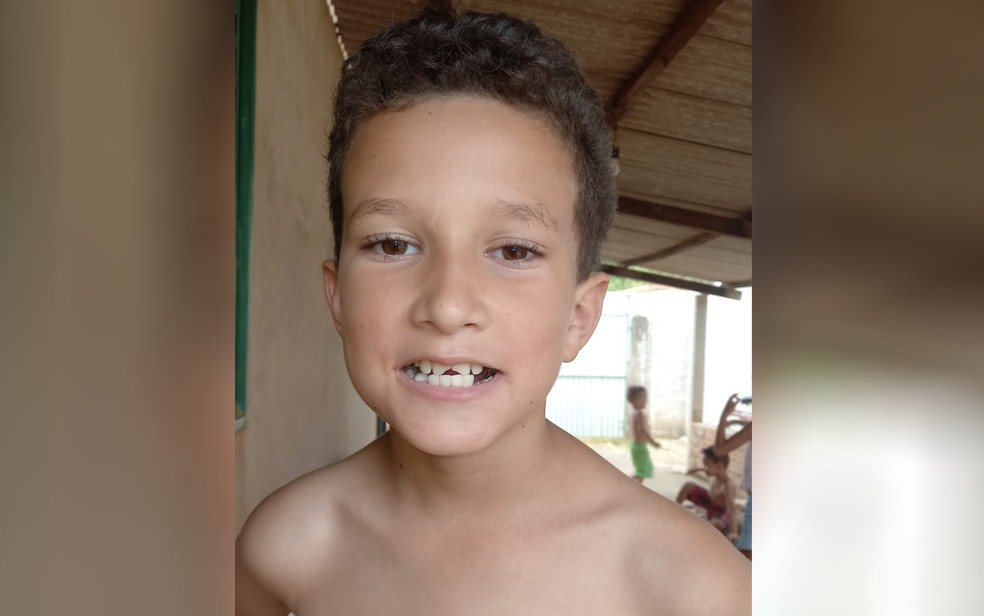 Imagem Ilustrando a Notícia: Em cartinha emocionante, menino de 9 anos pede dinheiro para arrumar os dentes quebrados ao Papai Noel