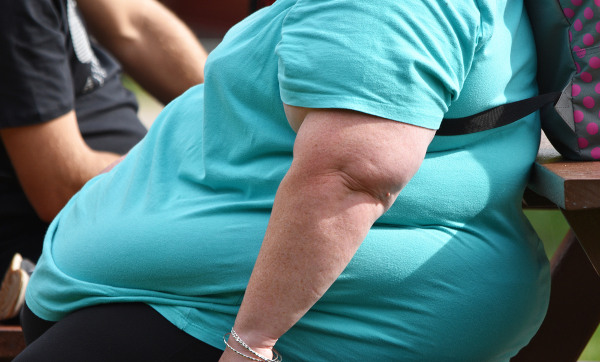 Imagem Ilustrando a Notícia: Obesidade: pessoas relatam as dificuldades para ter acesso à cirurgia bariátrica pelo SUS