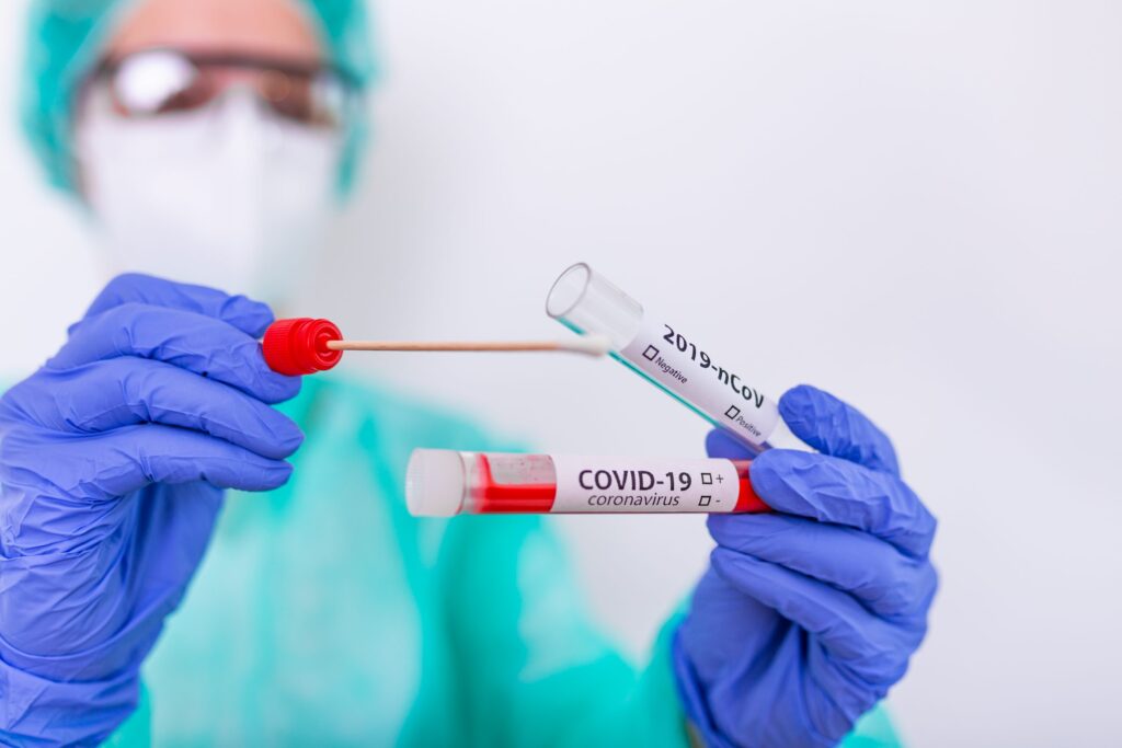 Imagem Ilustrando a Notícia: Laboratórios privados identificam aumento de casos positivos e na procura por testes de Covid-19