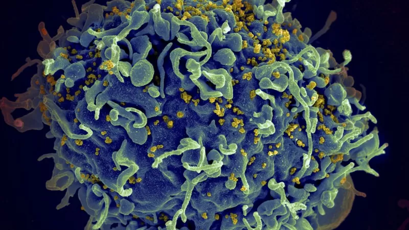 Imagem Ilustrando a Notícia: Nova variante do HIV é encontrada na Holanda; vírus possui carga viral mais transmissível e agressiva