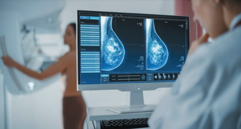 Imagem Ilustrando a Notícia: Pandemia expõe queda no número de mamografias e atrasa diagnóstico precoce do câncer de mama