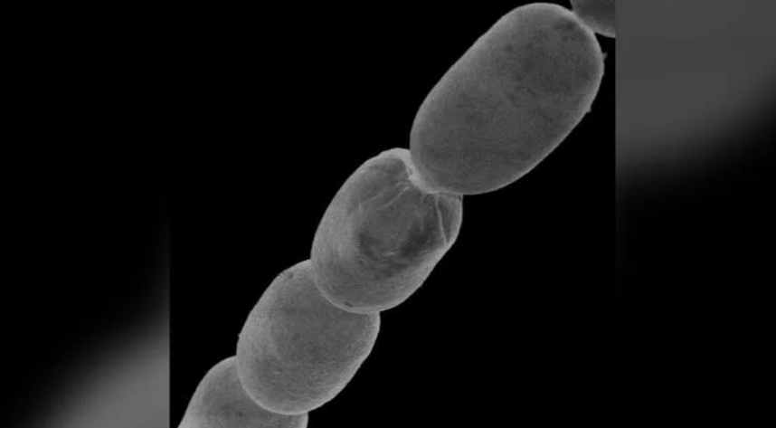 Imagem Ilustrando a Notícia: Descoberta: Cientistas estudam maior bactéria do mundo visível a olho nu