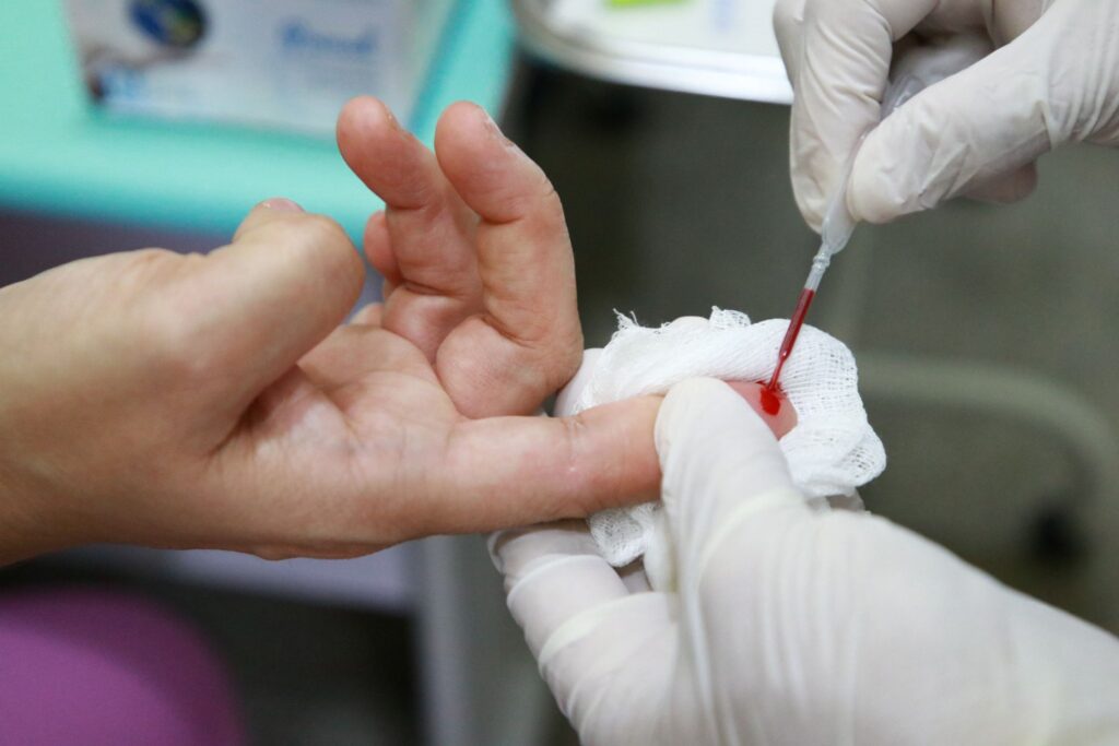 Imagem Ilustrando a Notícia: Goiás registra mais de 400 casos de hepatite em 2022