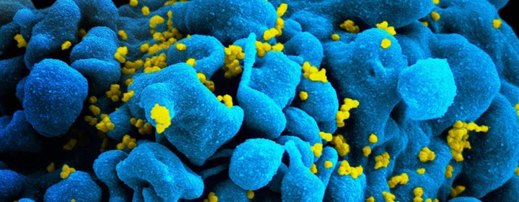 Imagem Ilustrando a Notícia: HIV: Cientistas apresentam 4º paciente curado