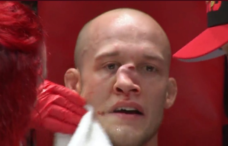 Imagem Ilustrando a Notícia: Lutador de MMA sofre fratura grave no nariz após levar joelhada no rosto; assista