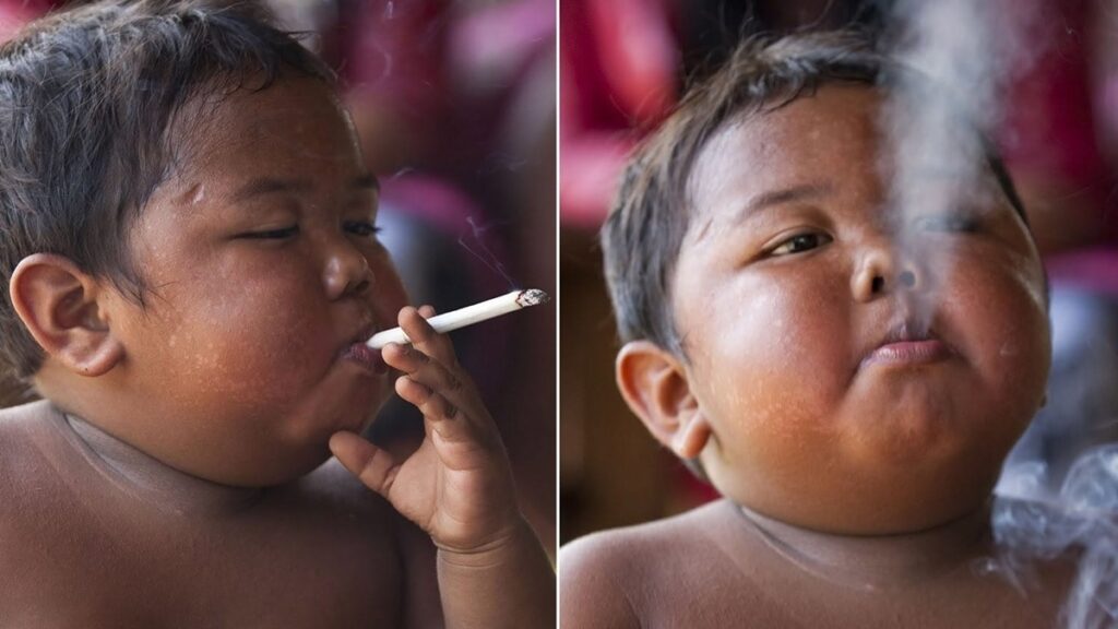 Imagem Ilustrando a Notícia: Aldi Rizal: Veja como está bebê fumante da Indonésia após 12 anos