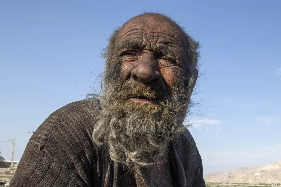 Imagem Ilustrando a Notícia: Homem conhecido por ser ‘o mais sujo do mundo’ morre aos 94 anos após tomar banho