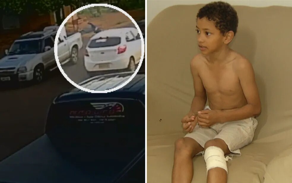 Imagem Ilustrando a Notícia: Criança que deu pirueta no ar após ser atingida por carro conta que estava fugindo de cães em Rio Verde; veja