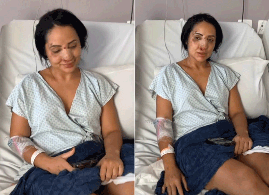 Imagem Ilustrando a Notícia: Irmã de Deolane Bezerra mostra rosto “estraçalhado” após discussão em bar e decide fazer cirurgia; assista