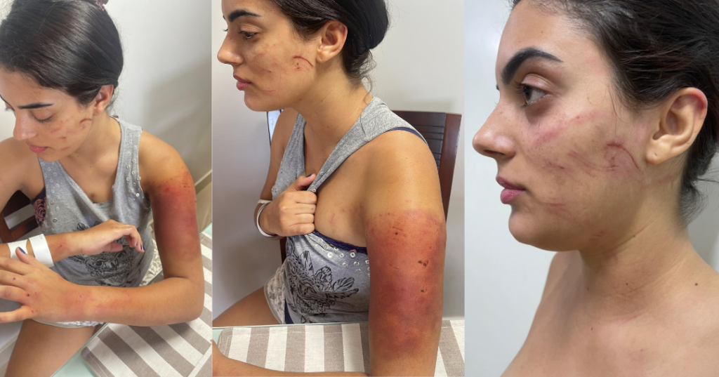 Imagem Ilustrando a Notícia: Tribunal concede medida protetiva para maquiadora agredida por ex-namorado