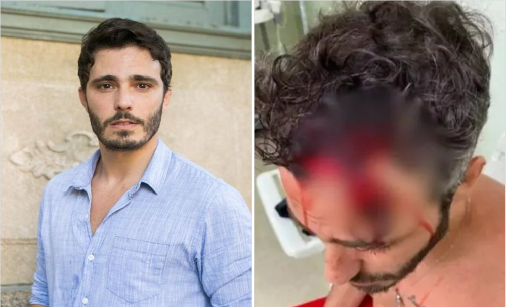 Imagem Ilustrando a Notícia: Investigação aponta que ator Thiago Rodrigues caiu sozinho; polícia descarta assalto