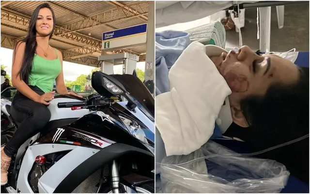 Imagem Ilustrando a Notícia: Enfermeira que foi atropelada não consegue falar nem andar, diz o marido