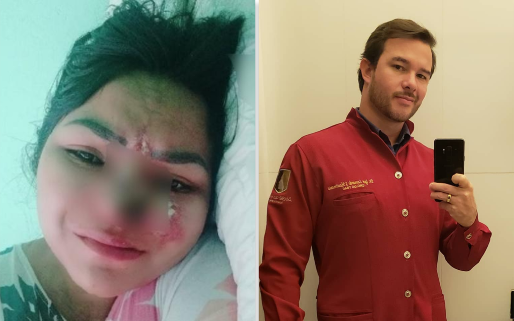 Imagem Ilustrando a Notícia: Dentista praticou lesão corporal em mulher que perdeu parte do nariz após cirurgia estética, conclui Polícia Civil