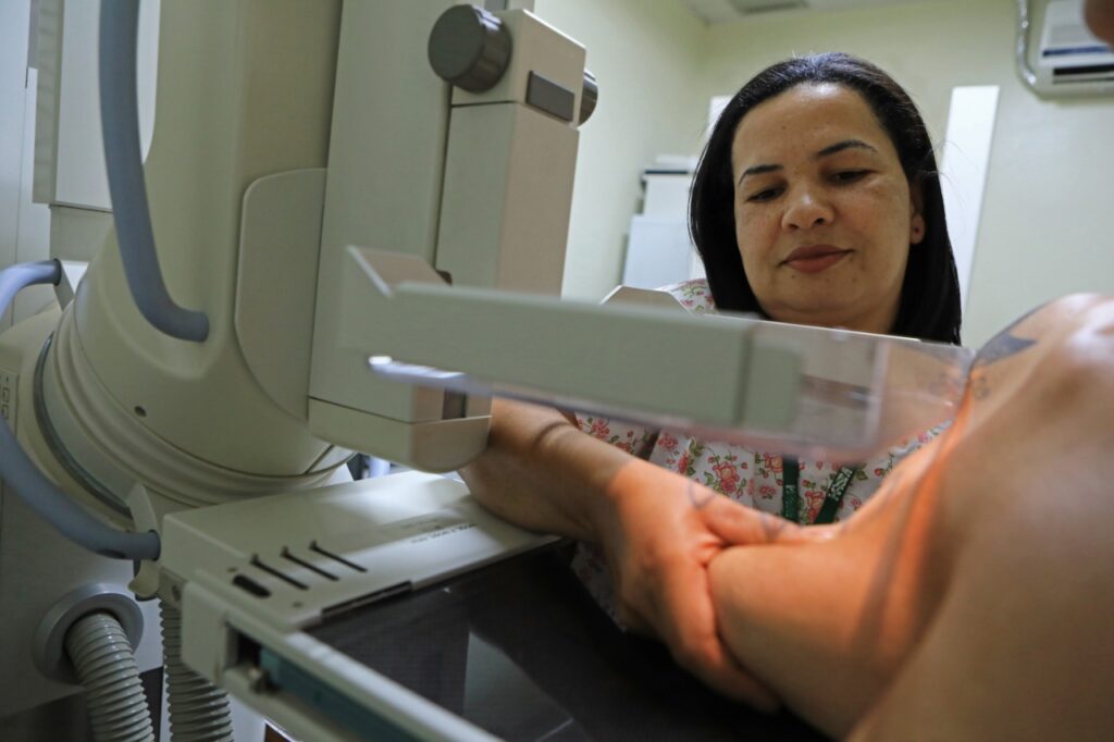 Imagem Ilustrando a Notícia: Mamografia: informações sobre o exame que toda mulher precisa saber