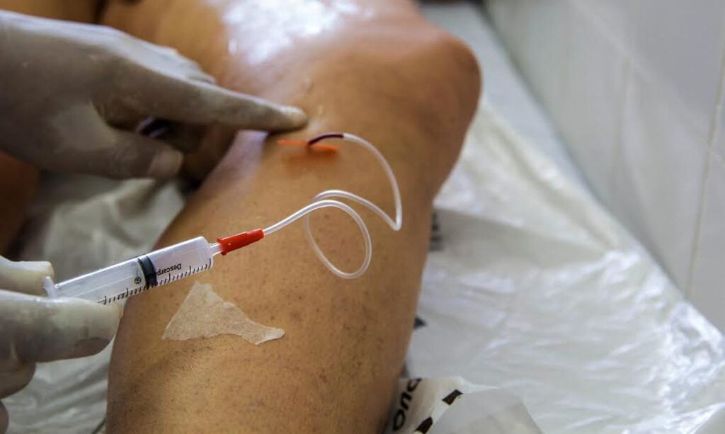Imagem Ilustrando a Notícia: Mais de 140 mulheres são internadas por dia para tratar varizes