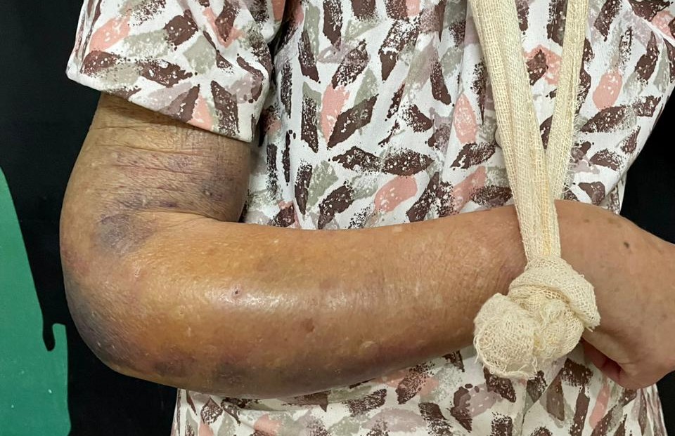 Imagem Ilustrando a Notícia: Operação prende filha por abandono e maus-tratos a mãe de 87 anos, no Setor Bueno