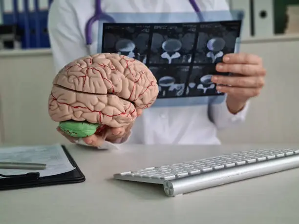 Imagem Ilustrando a Notícia: Cientistas do Reino Unido e da Bélgica descobrem como Alzheimer mata os neurônios