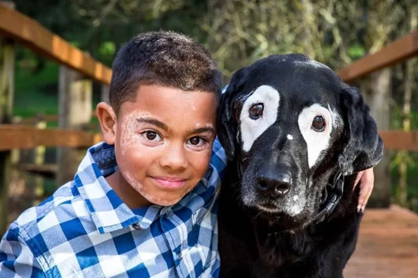 Imagem Ilustrando a Notícia: Criança sai da depressão após conhecer cachorro com a mesma doença que ele