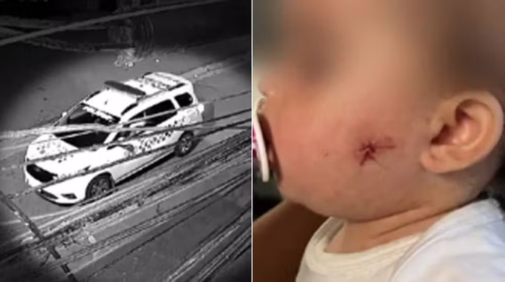 Imagem Ilustrando a Notícia: Policiais são afastados após darem tiro no rosto de bebê de 1 ano, em São Paulo