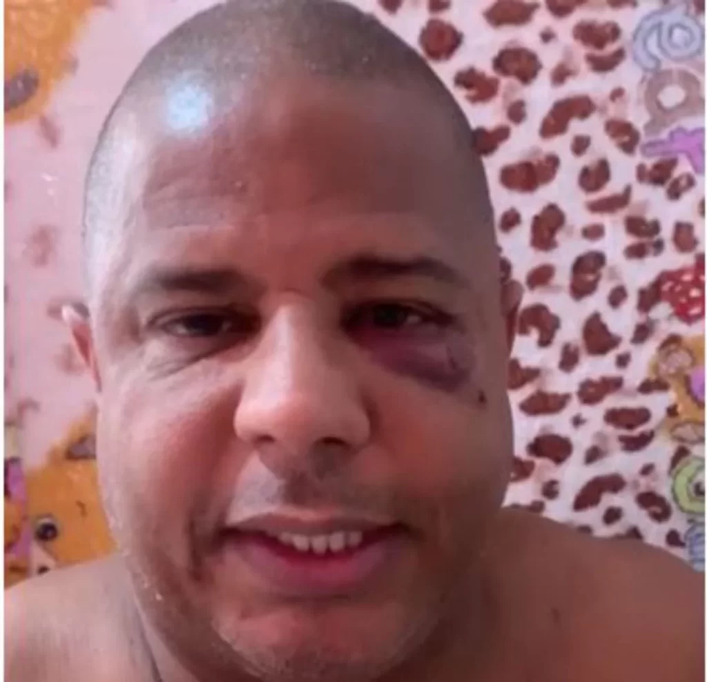 Imagem Ilustrando a Notícia: Marcelinho Carioca aparece em vídeo confirmando que foi sequestrado após sair com mulher casada; assista