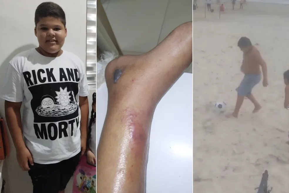 Imagem Ilustrando a Notícia: Menino de 12 anos morre após fraturar tornozelo e família exige justiça por negligência hospitalar
